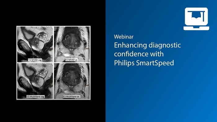 Enhancing Diagnostic Confidence with Philips SmartSpeed video thumb