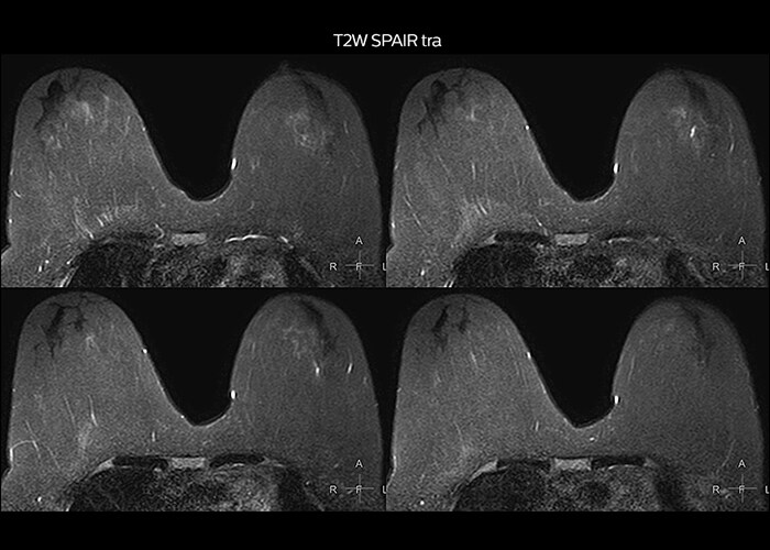 clinical cases tab3 image