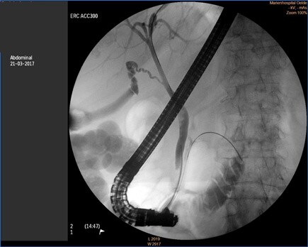 case1 image