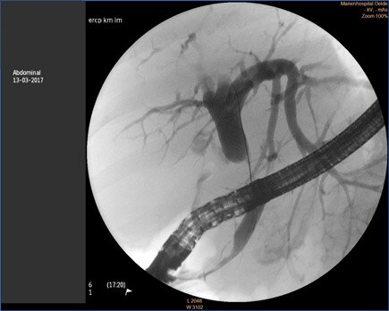 case2 image