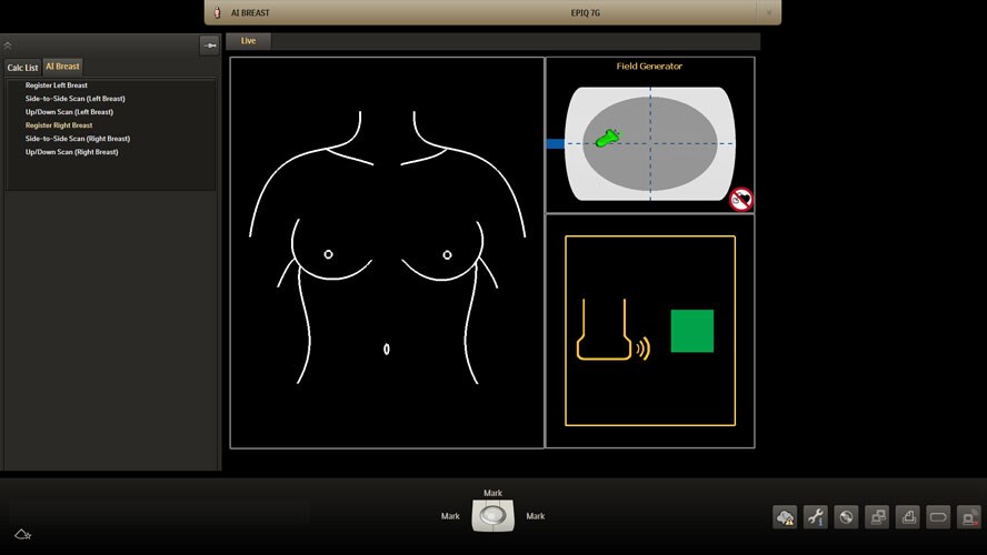 AI breast registration screen