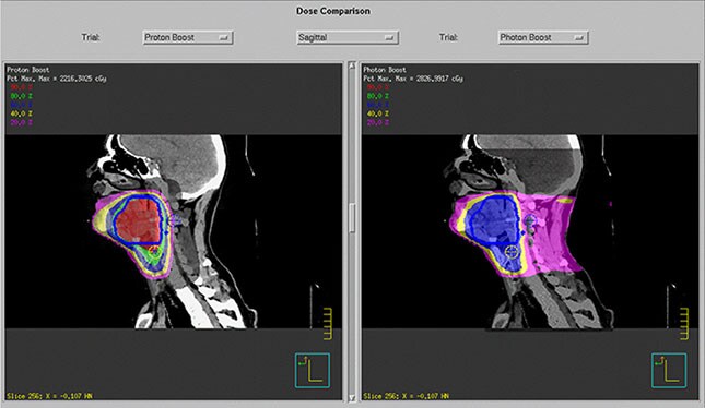 proton planning enhanced tissue sparing L