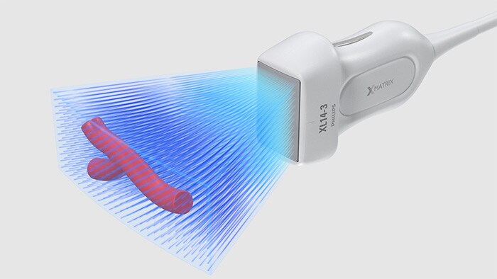 The Philips XL14-3 xMATRIX linear array transducer vascular ultrasound with easy 3D/4D capability