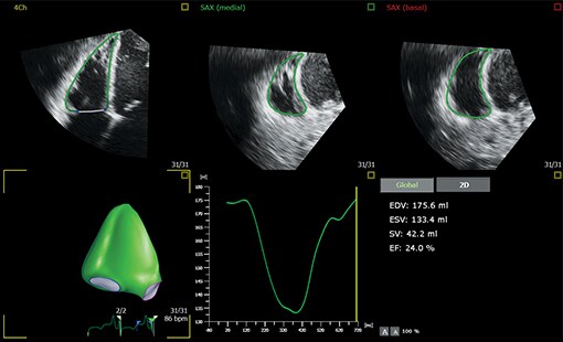 aius-study-results