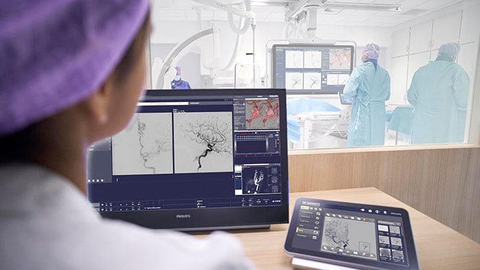 Philips calls for global action on stroke awareness and access to life-saving care
